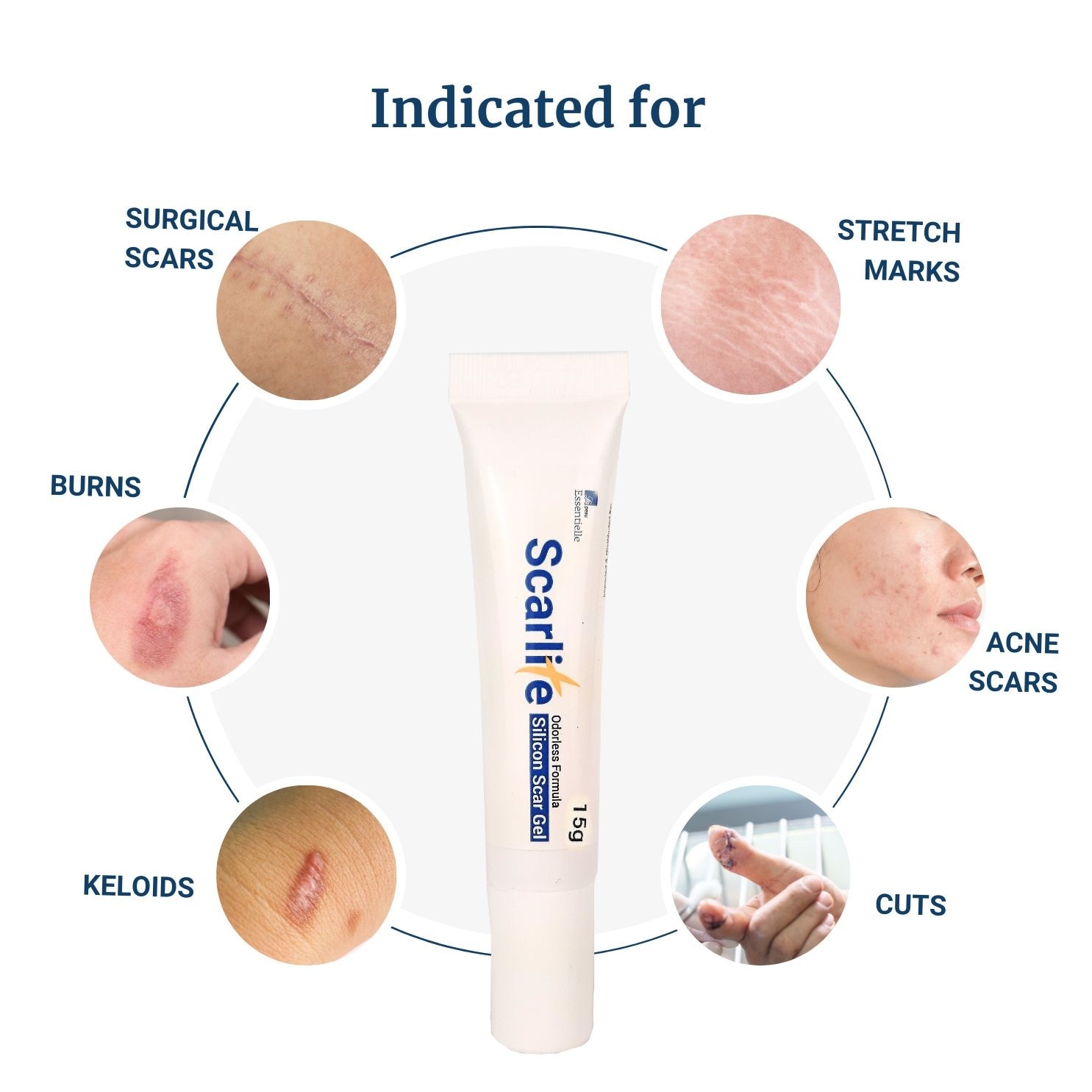 SCARLITE Silicon scar gel 15 grams