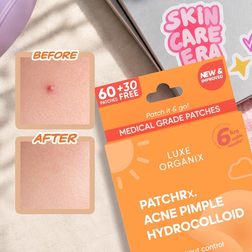 LUXE ORGANIX PatchRx All Day Acne Pimple Hydrocolloid Patch 90s image