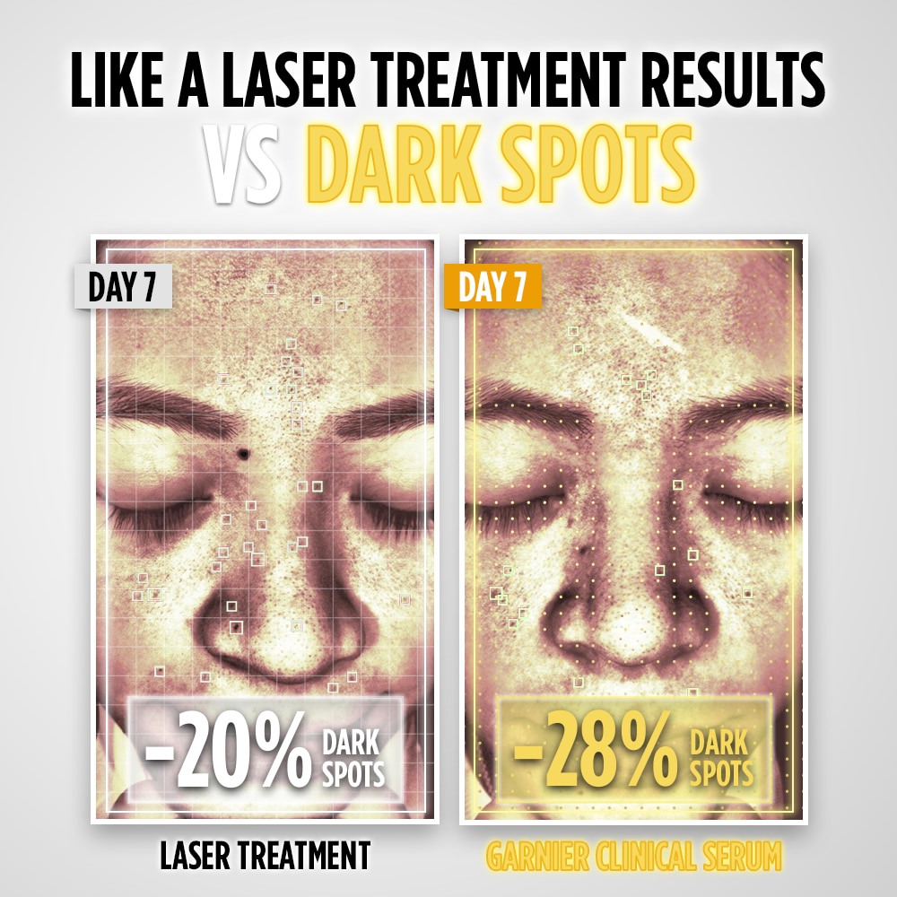 GARNIER Clinical Serum with Tranexamic Acid 30ml image