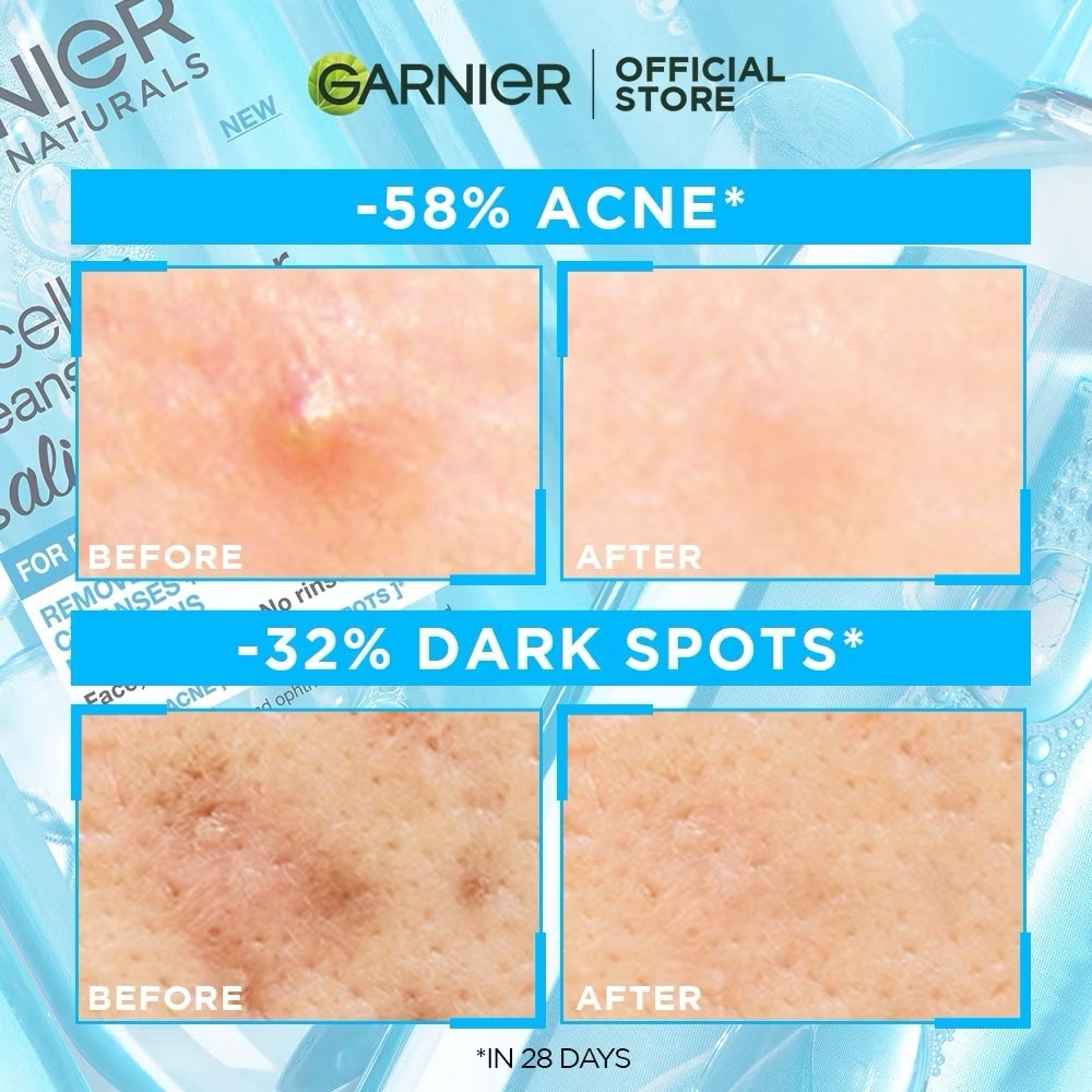 GARNIER Bright Complete Anti Acne 3 in 1 Cleanser 100ml image