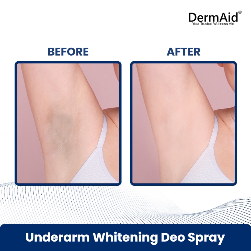 DERMAID Underarm Whitening Deodorant Spray 100ml