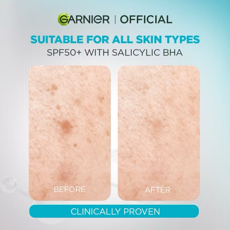 GARNIER Anti Acne UV Sunscreen 30ml image