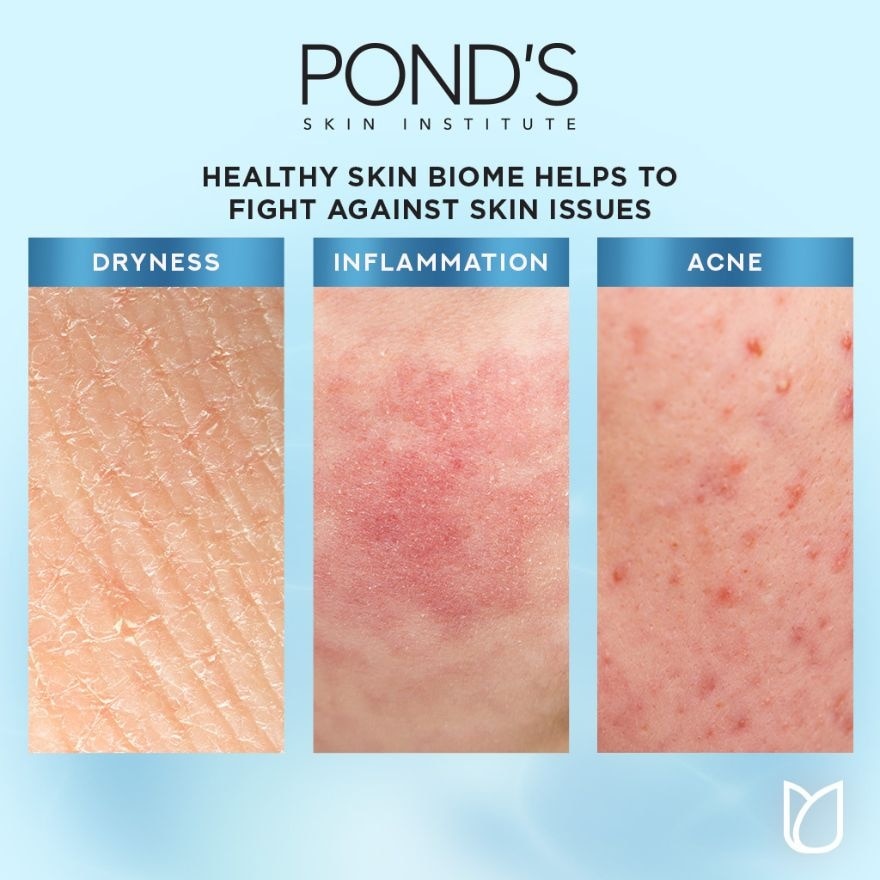 PONDS Hydra Miracle Moisturizer Ultra Light Biome Gel 20g