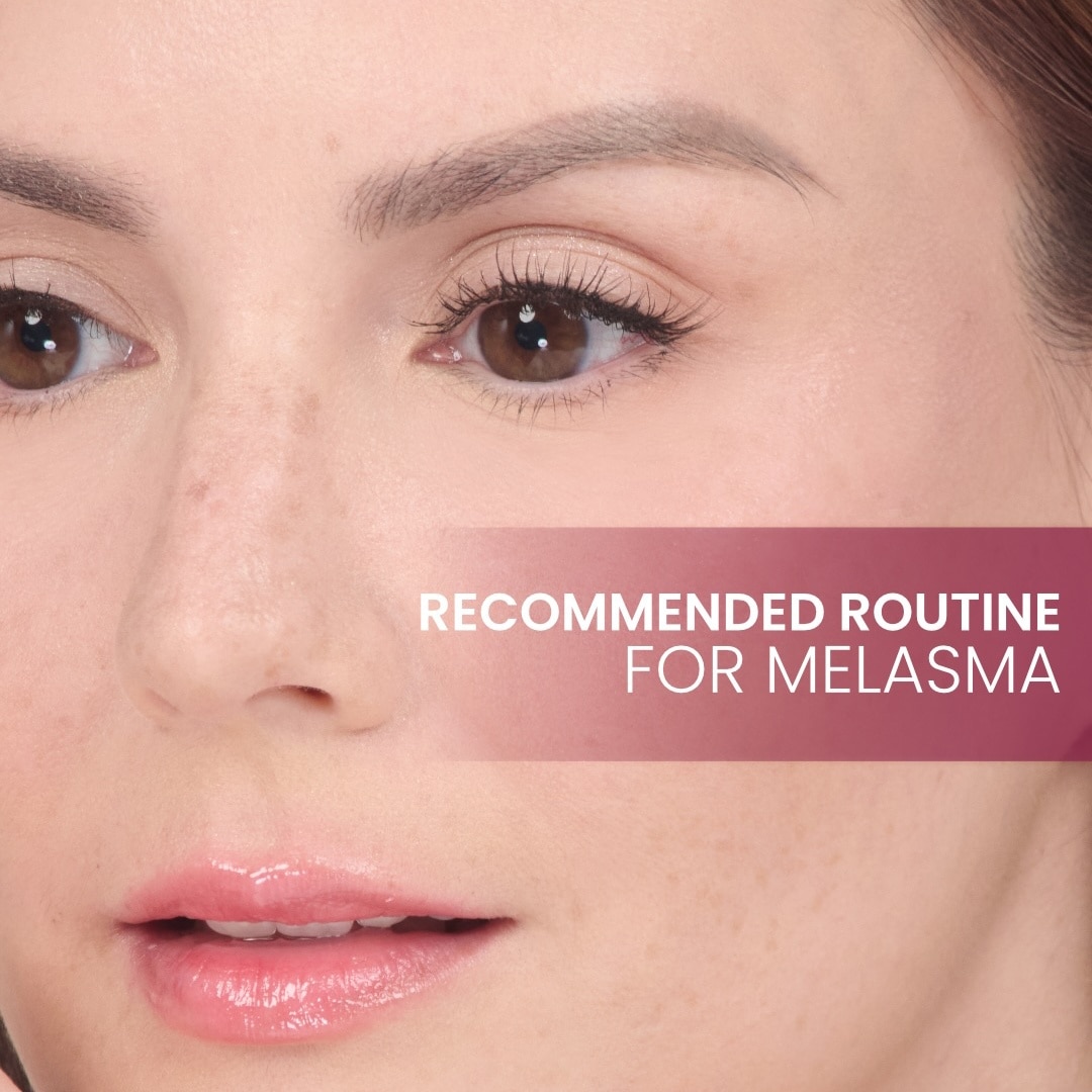 LUXE ORGANIX DermaPRO TXA Melasma Clear Exo-10 Exosome Bright Treatment Cream 150ml