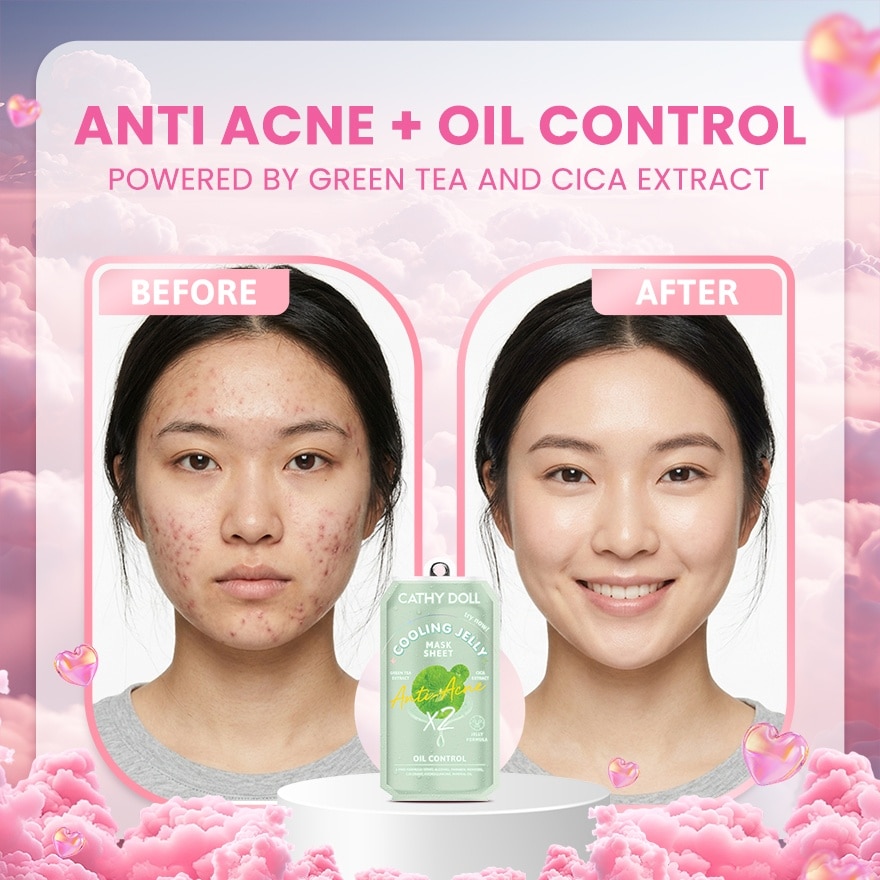 CATHY DOLL Anti-Acne Cooling Jelly Mask 25g image