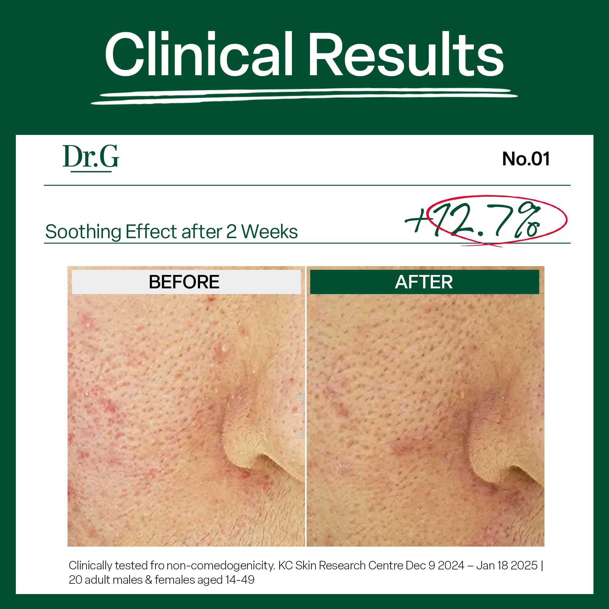 Dr.G R.E.D Blemish Hyal Cica Soothing Cooling Gel Mask image