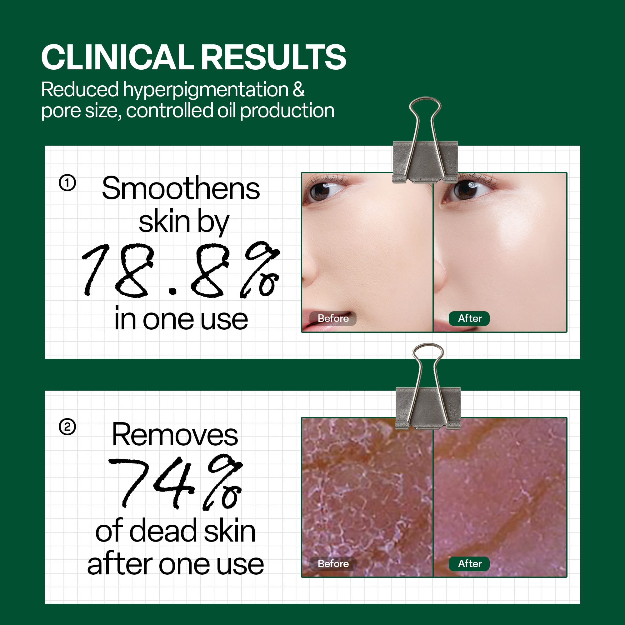 Dr.G Brightening Peeling Gel 80g image