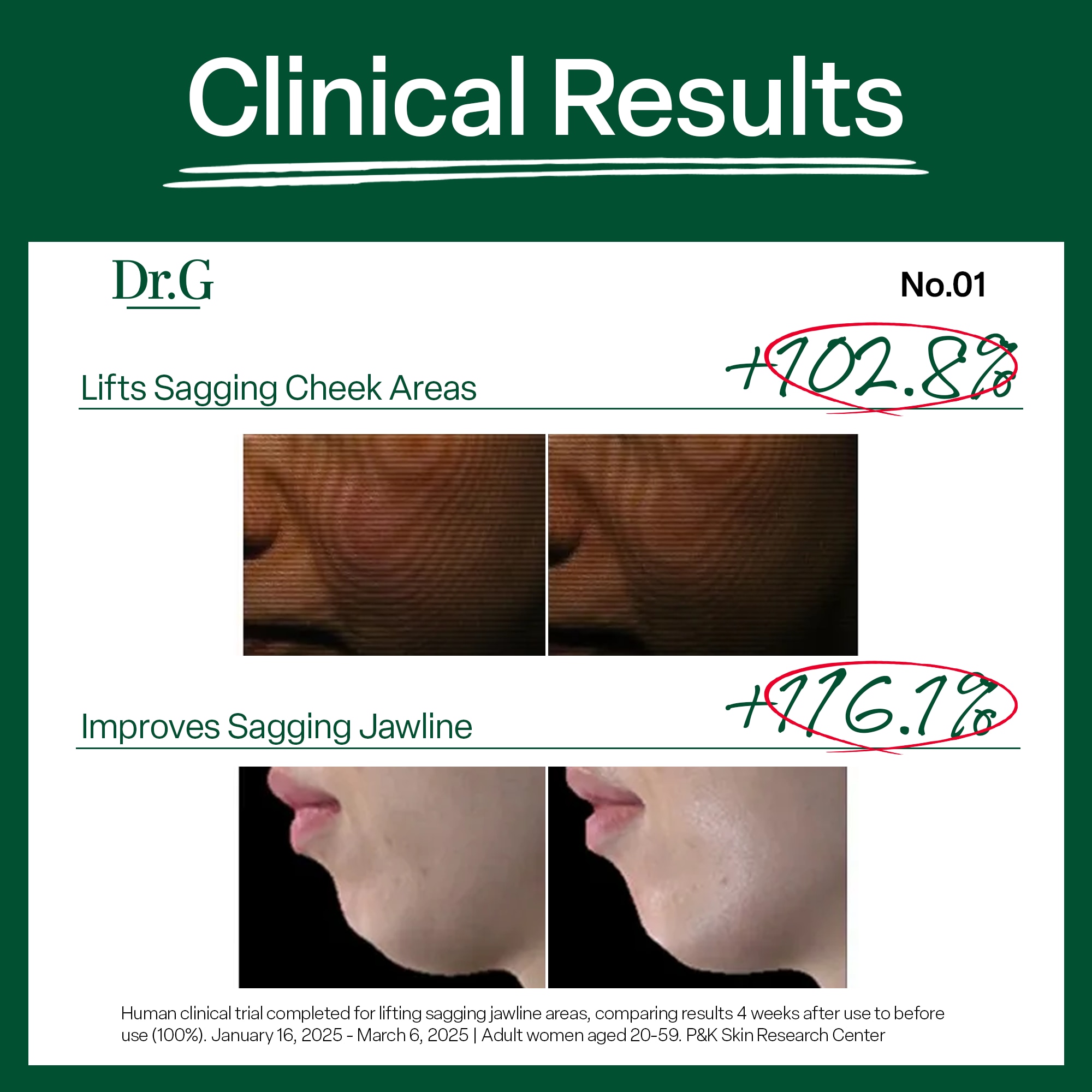 Dr.G Black Snail Retinol Collagen Serum Intense 30ml image