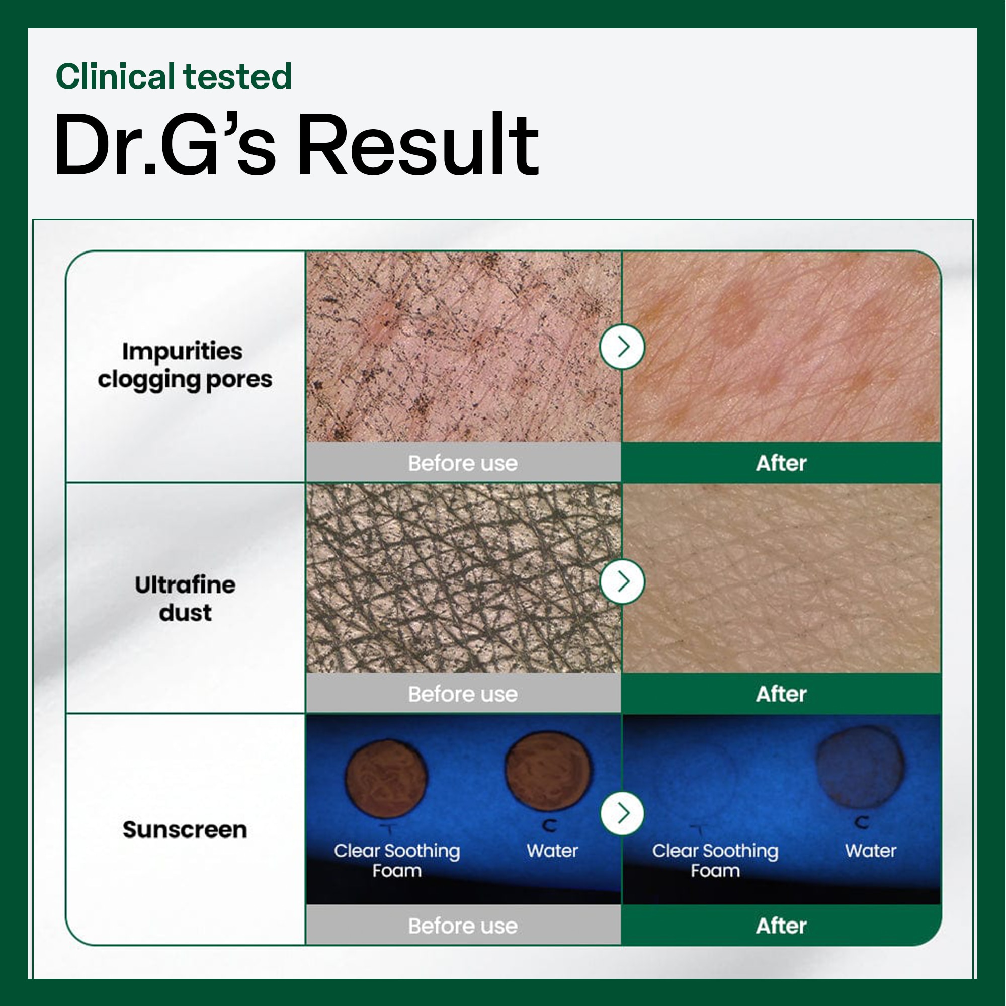 Dr.G R.E.D Blemish Clear Soothing Toner 150ml image