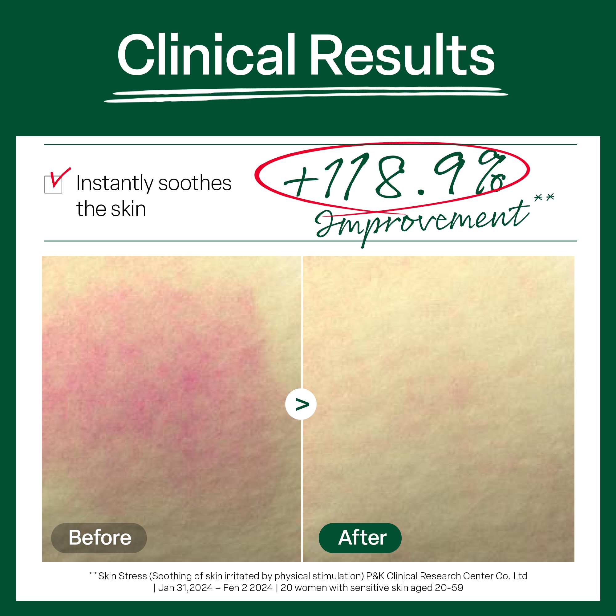 Dr.G pH R.E.D Blemish Clear Soothing Foam 150ml image