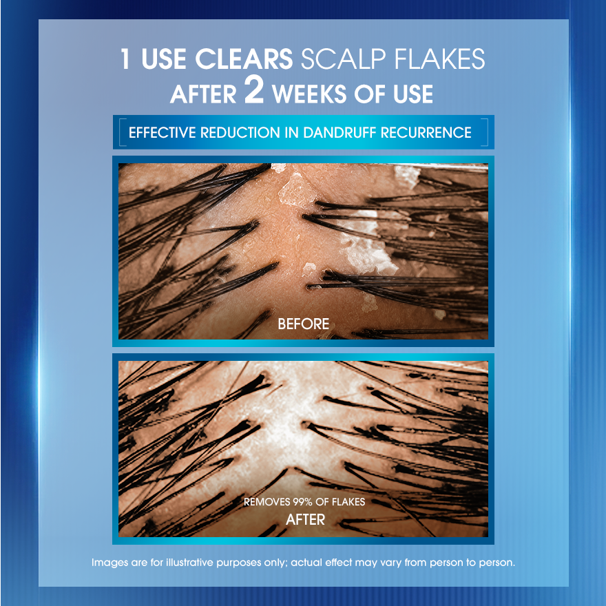 CLEAR Scalp Derma Serum Dandruff Defense 50ml image
