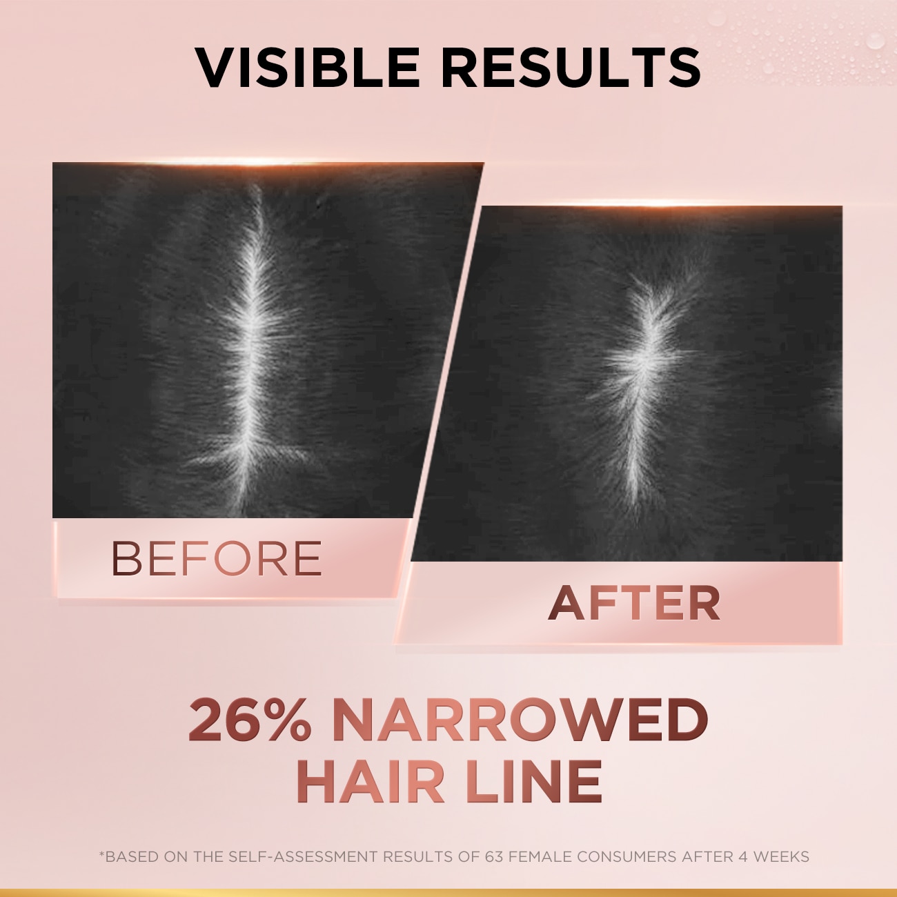 ELSEVE Full Resist Conditioner 440ml