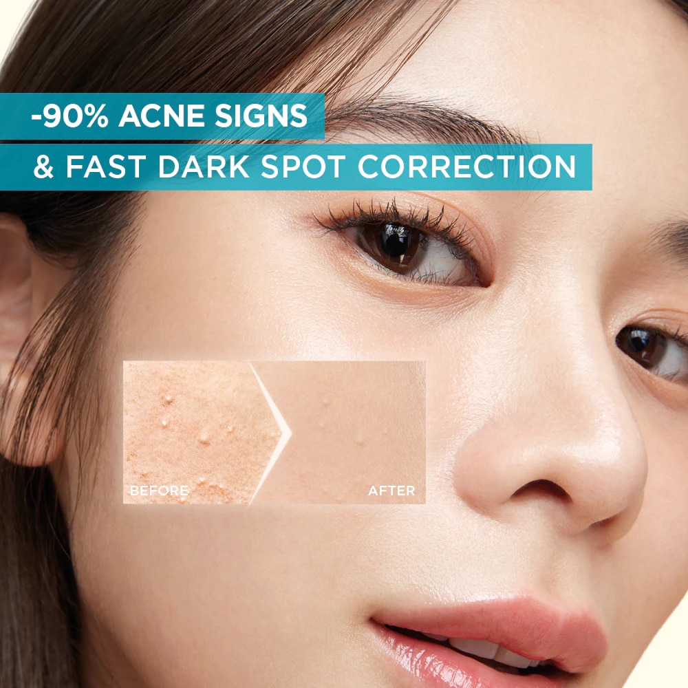 GARNIER Bright Anti-Acne Booster Serum 8ml