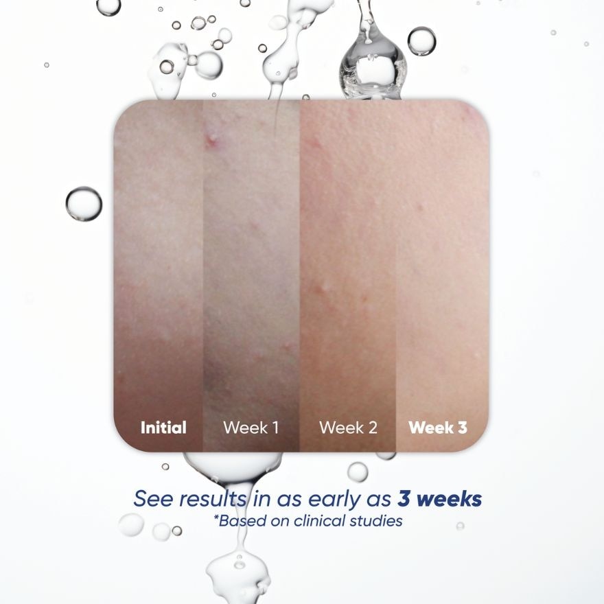 Kojic Plus Acne Control Toner 100mL image