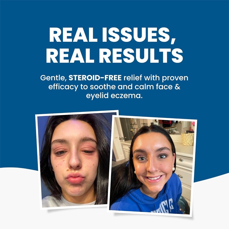 GRAHAMS NATURAL Face & Eyelid Eczema 50g