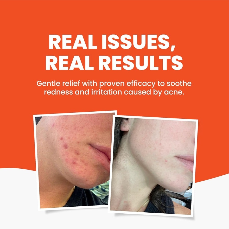 GRAHAMS NATURAL Acne Wash 125ml