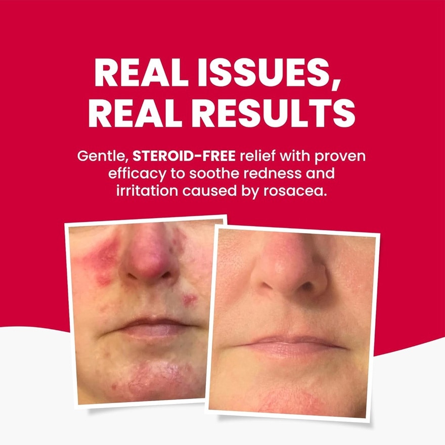 GRAHAMS NATURAL Rosacea Cream 75g