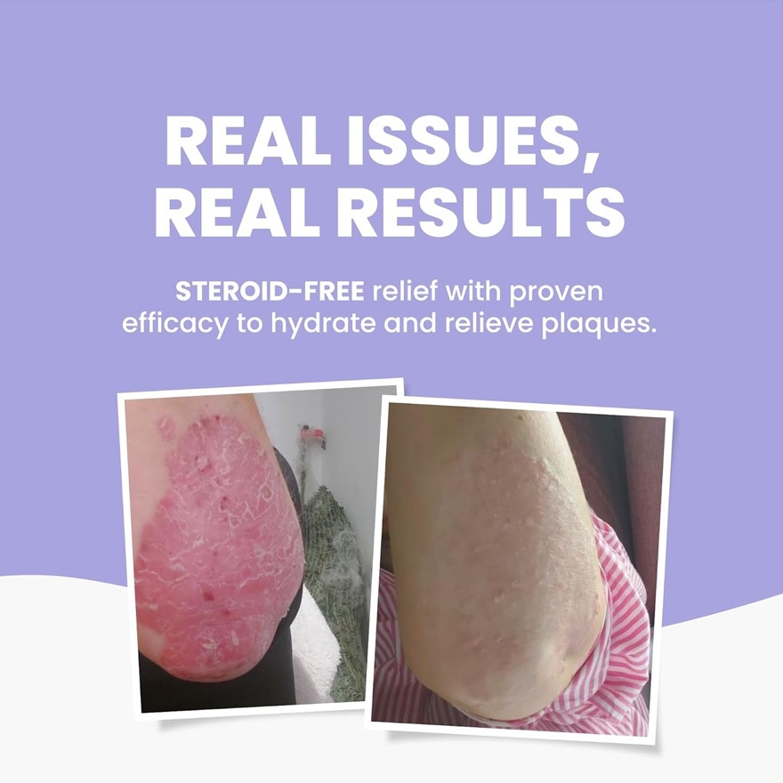 GRAHAMS NATURAL Psoriasis Cream 75g