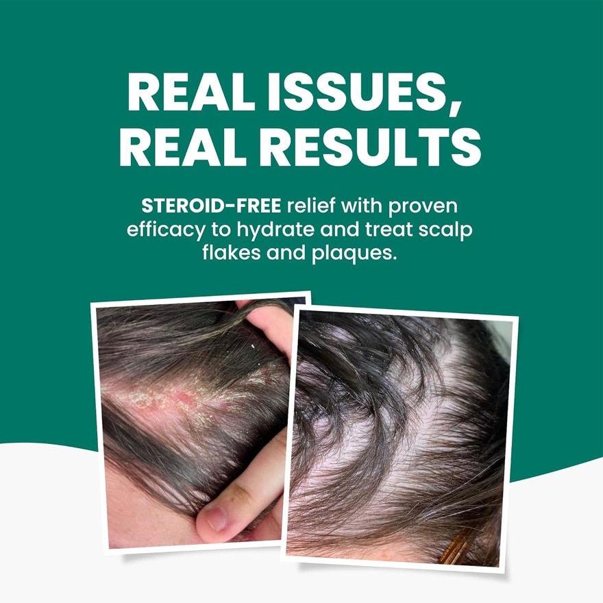 GRAHAMS NATURAL Scalp Relief Shampoo 250ml