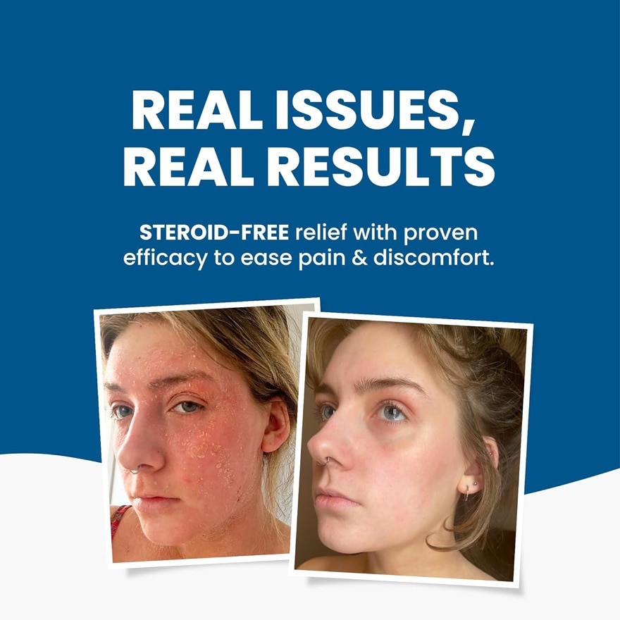 GRAHAMS NATURAL C Plus Eczema Cream 50g