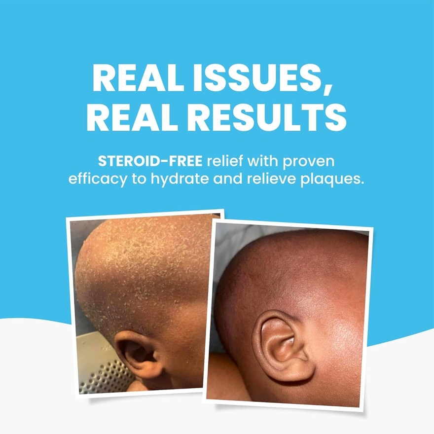 GRAHAMS NATURAL Eczema Body And Bath Oil 100ml