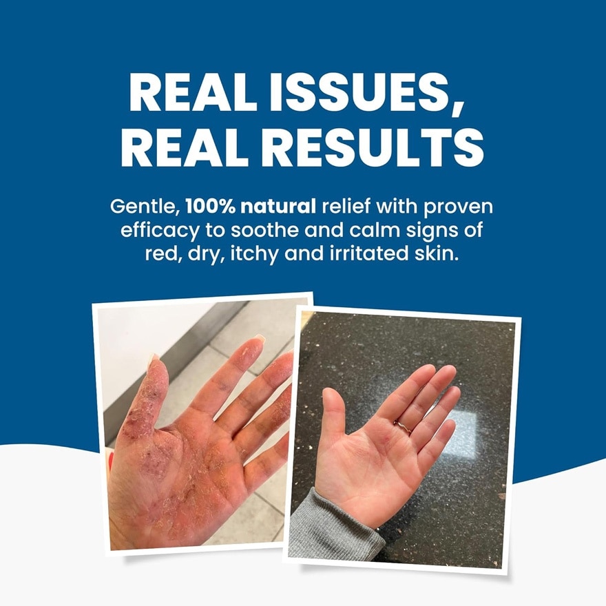 GRAHAMS Natural Skin Therapy Oil 100ml