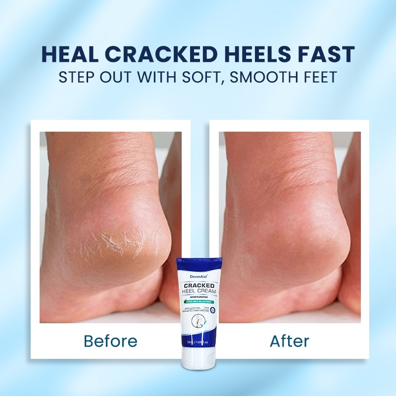 Cracked Heel Cream 50ml