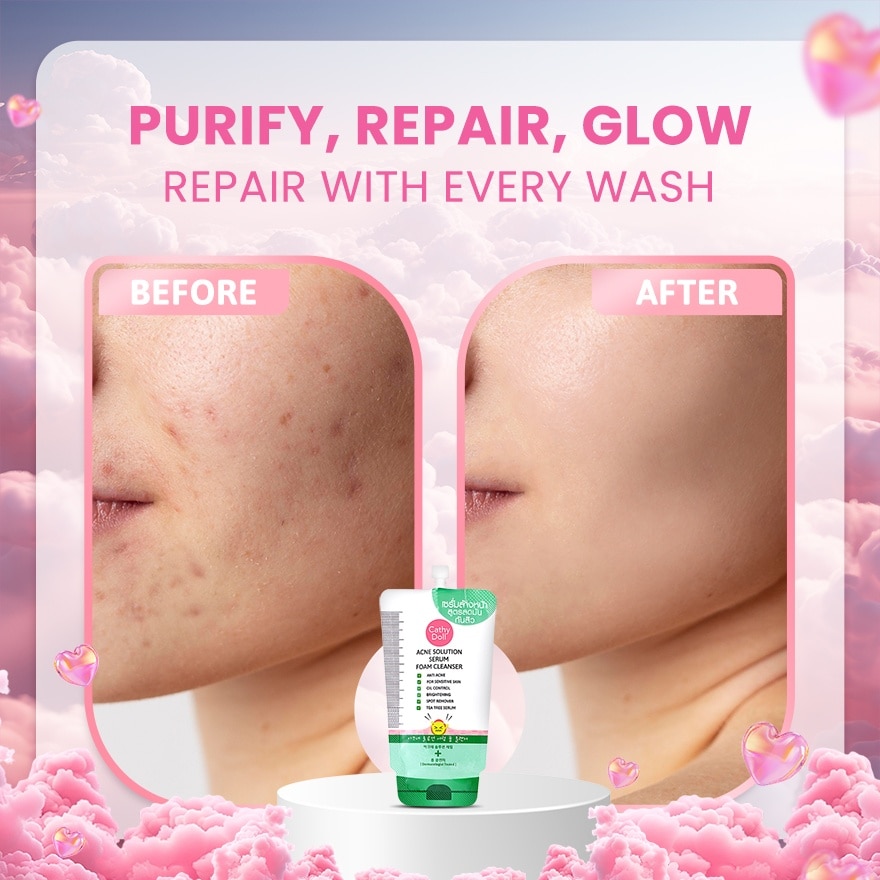 Acne Solution Serum Foam Cleanser 12ml