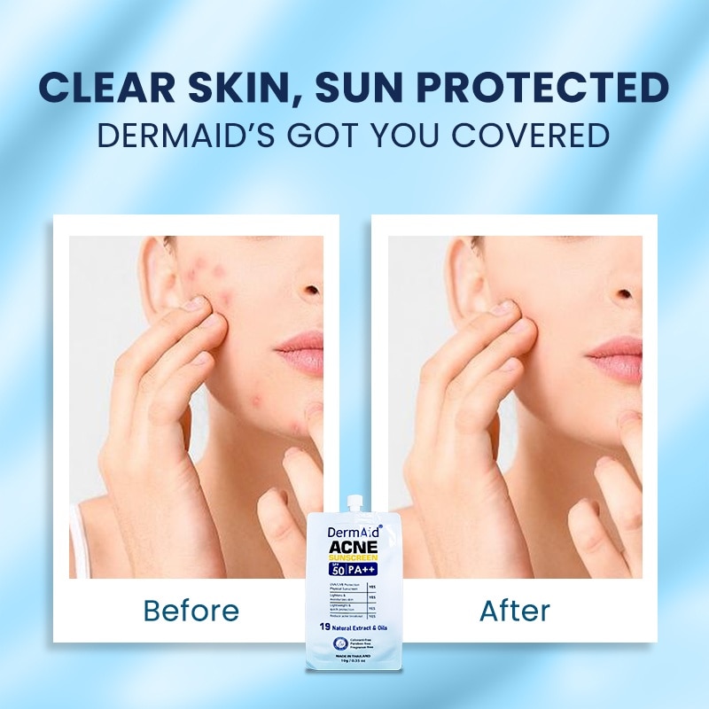 Dermaid Acne Sunscreen 10g