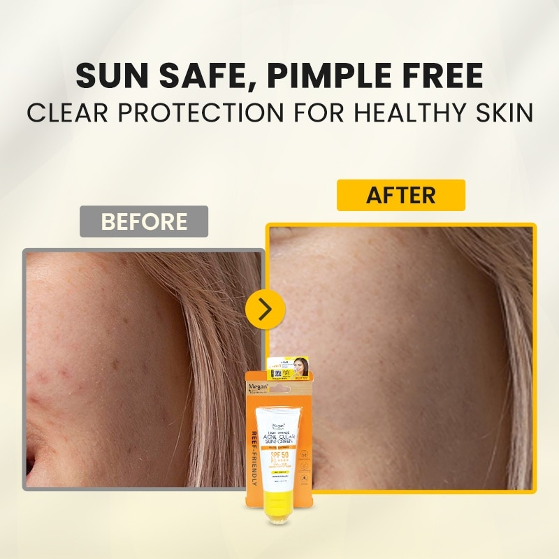 MEGAN Eco Beauty High Defense Acne Clear SPF 50 ++++