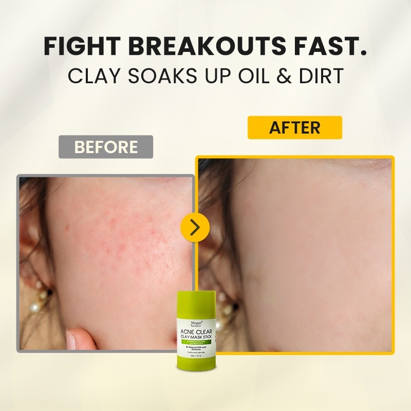 MEGAN Eco Beauty Acne Clear Clay Mask Stick 40g