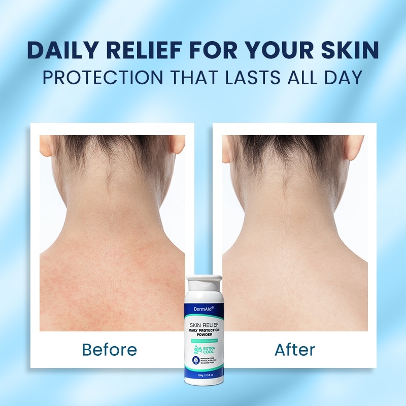 DERMAID Extra Cool Prickly Heat Powder 100g