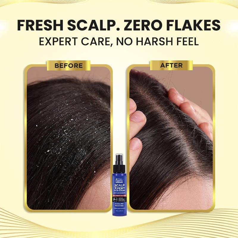 HAIRFIX Professional ScalpXpert Hair Serum Cooling Menthol 70ml