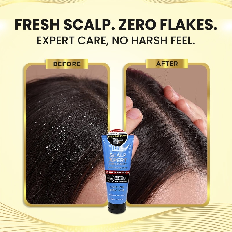 HAIRIFX Professional ScalpXpert Treatment Cooling Menthol 200ml