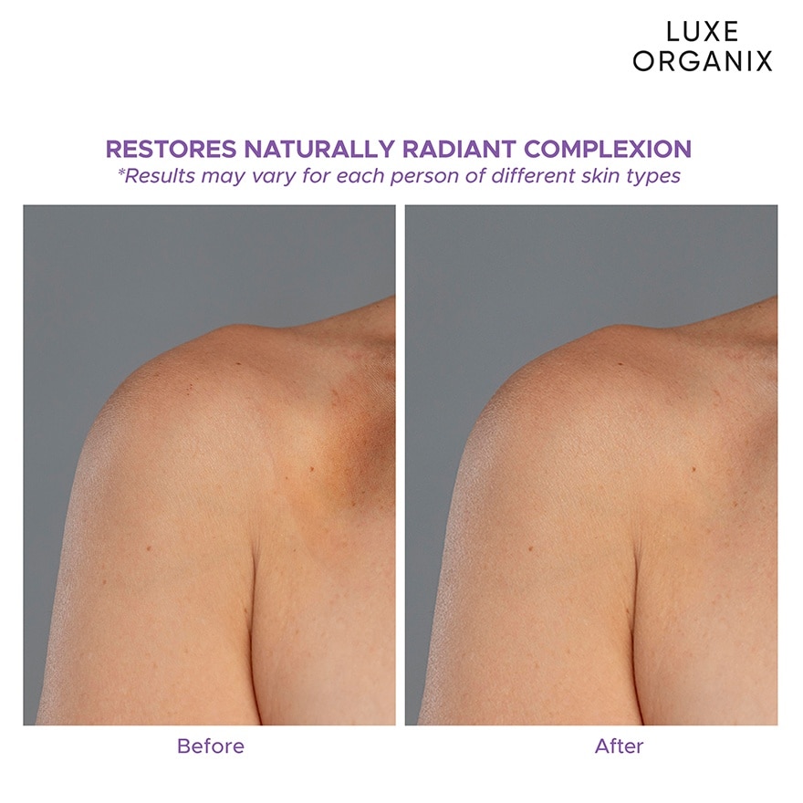 Retinol + Gluta Whitening Serum Lotion Buy 1 Take 1 350ml