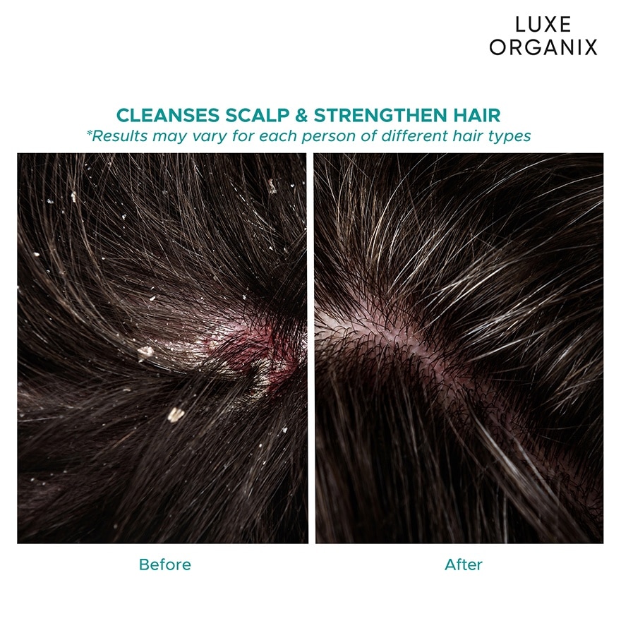 LUXE ORGANIX Scalp Therapy Anti-Hair Fall Strengthening Conditioner 250ml