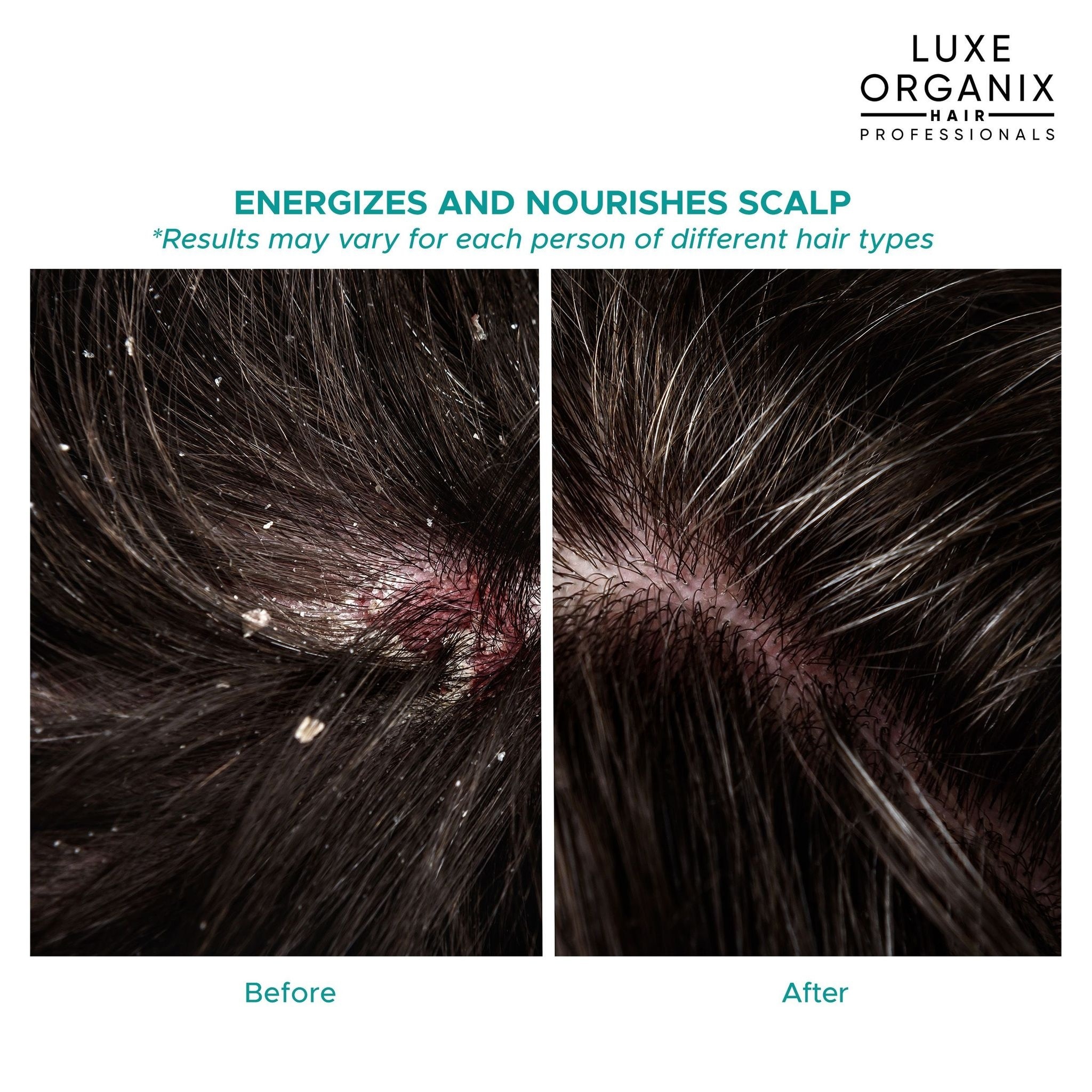LUXE ORGANIX Scalp Therapy Anti-Hair Fall Energizing Hair Serum 80ml