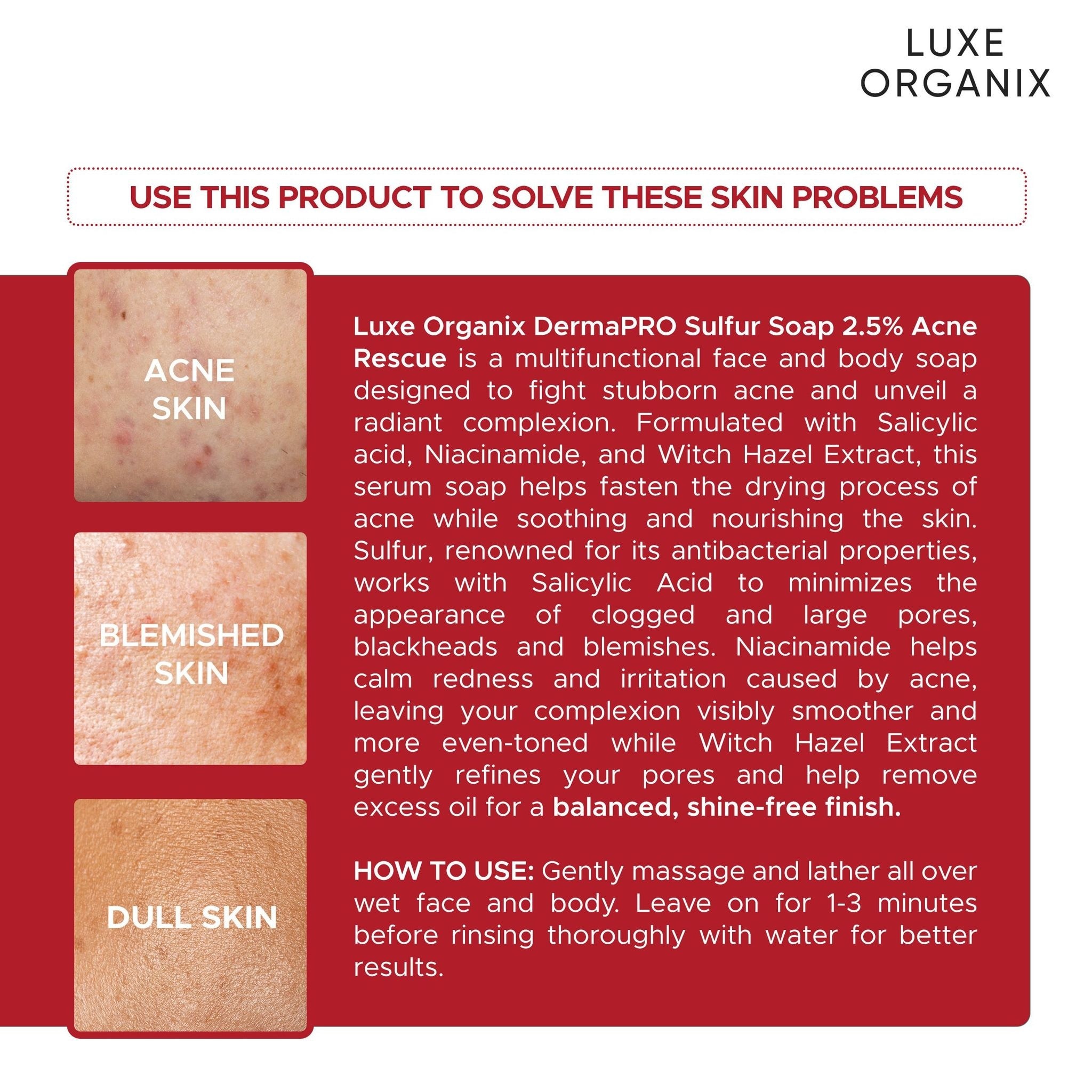 LUXE ORGANIX Dermapro Sulfur Soap 2.5% Acne Rescue 80g