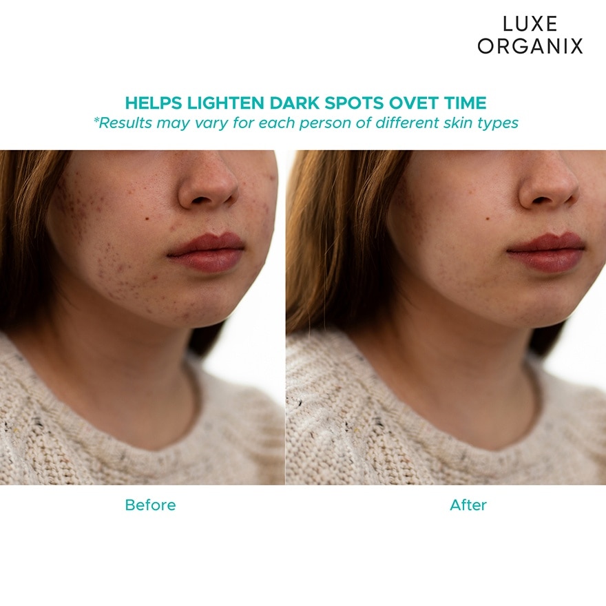 Miracle Solutions Acne Derm+ Tencel Sheet Mask 25g image