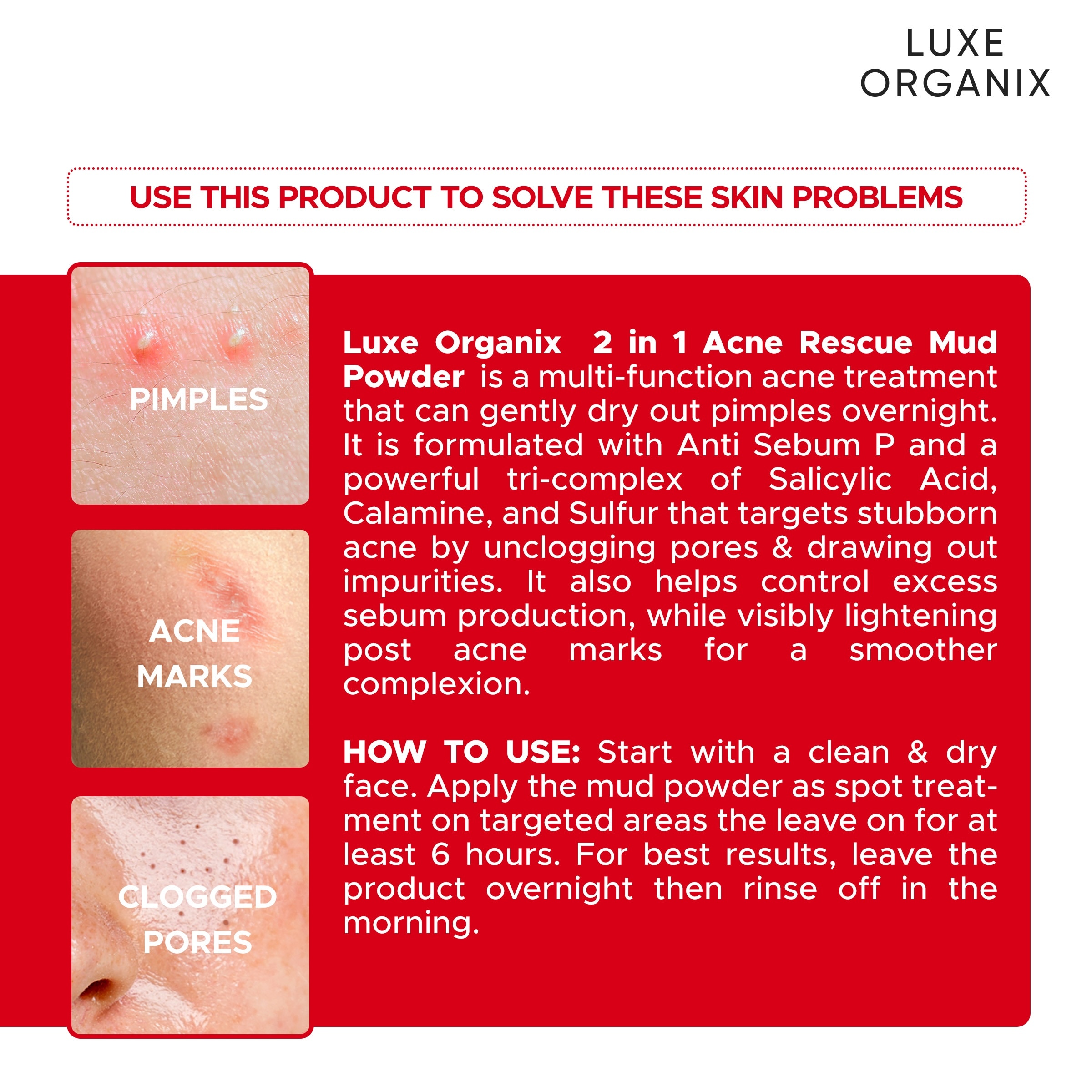 LUXE ORGANIX 2 in 1 Acne Rescue Mud Powder Overnight Pimple Drying 9g