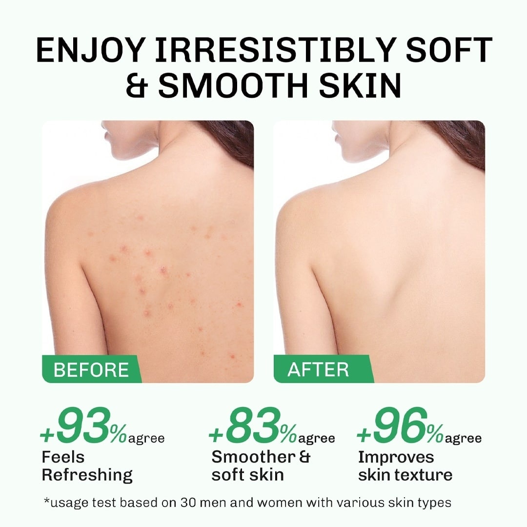 LAVOJOY Solve It Now Body Serum 180ml