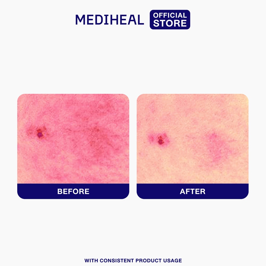 MEDIHEAL Hyaluronate Cleanser Ultra Hydration