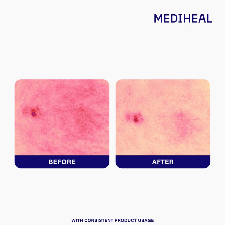 MEDIHEAL Collagen Cleanser Glow Firming image