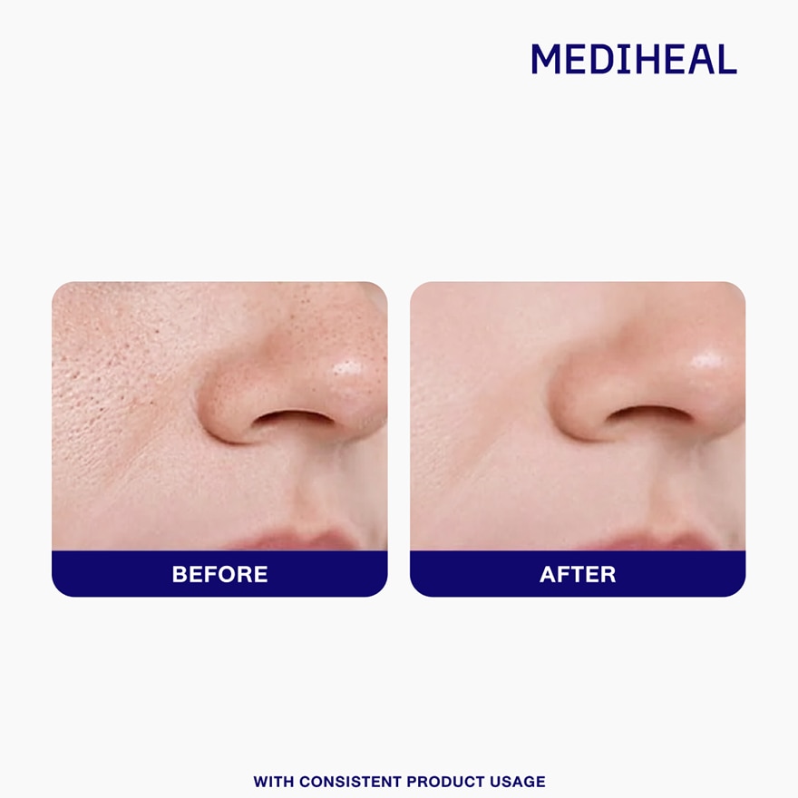 MEDIHEAL Collagen Essential Mask Core Firming 10