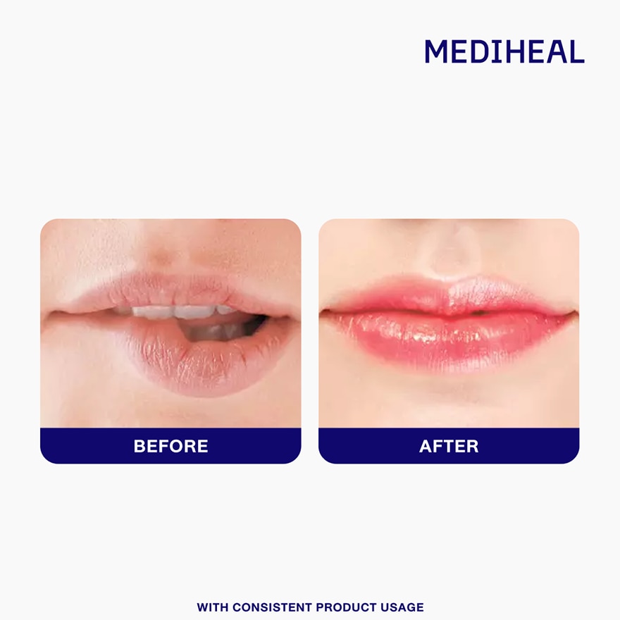 MEDIHEAL Panteno Lips Essence Berry Pink