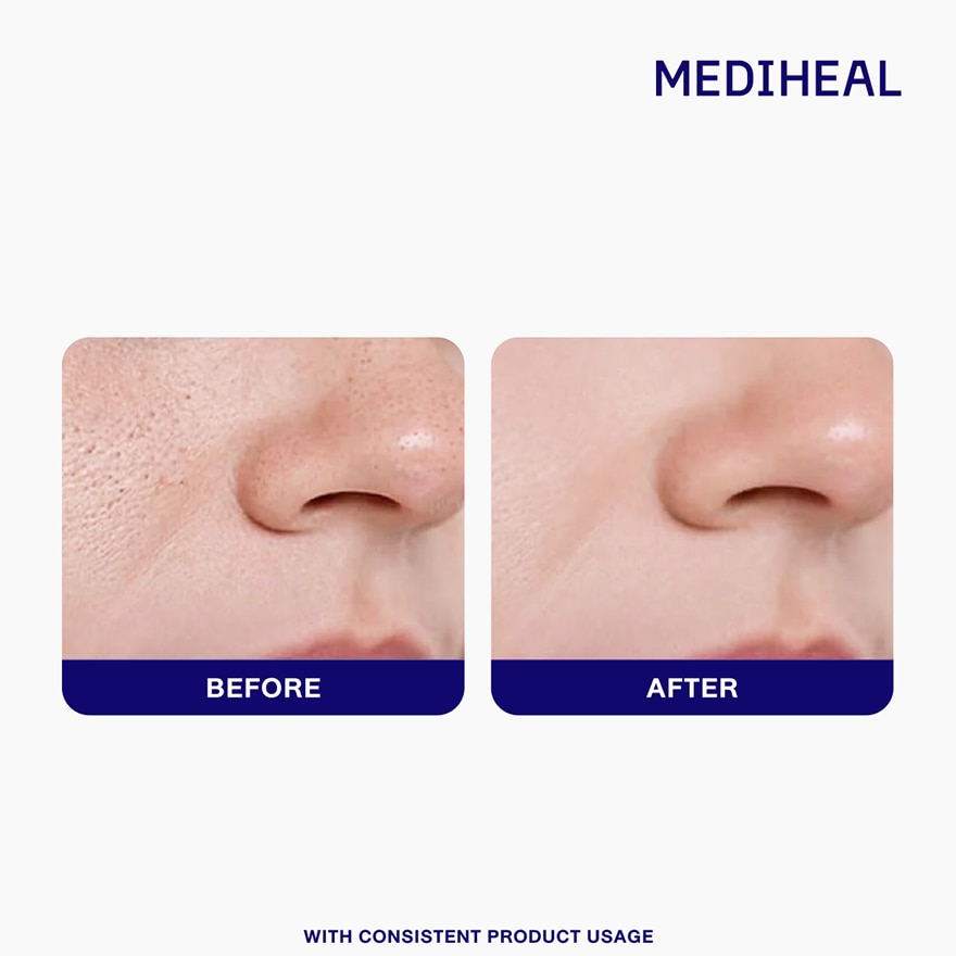 MEDIHEAL Teatree Essential Mask Calming Moisture image
