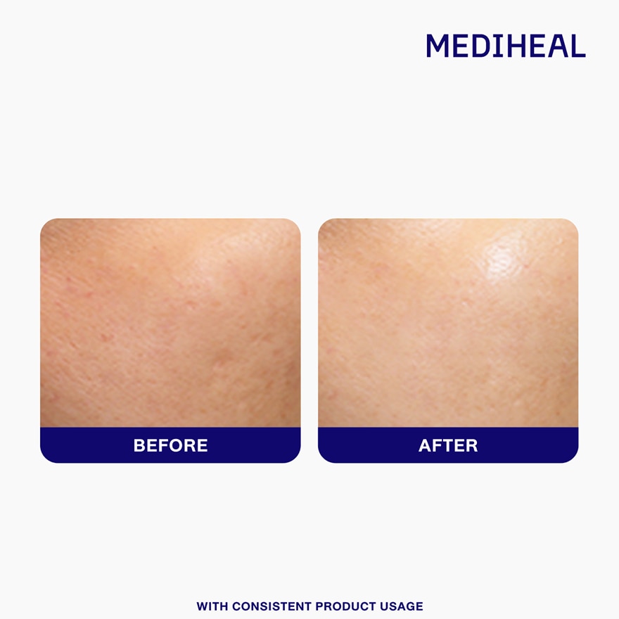 MEDIHEAL Moisture Tone Up Sun Cream