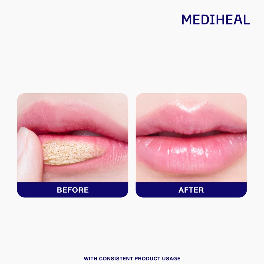 MEDIHEAL Pantenolips Scrub