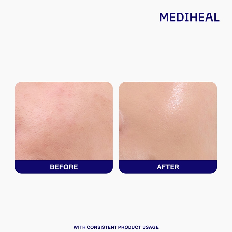 MEDIHEAL Low Molecular Hyaluronic Hydrate Dewy Serum image