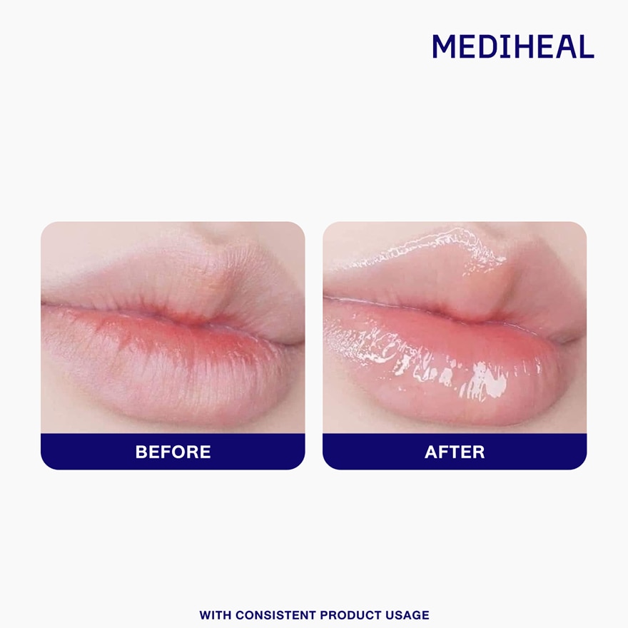 MEDIHEAL Panteno Lips Sleeping Mask image